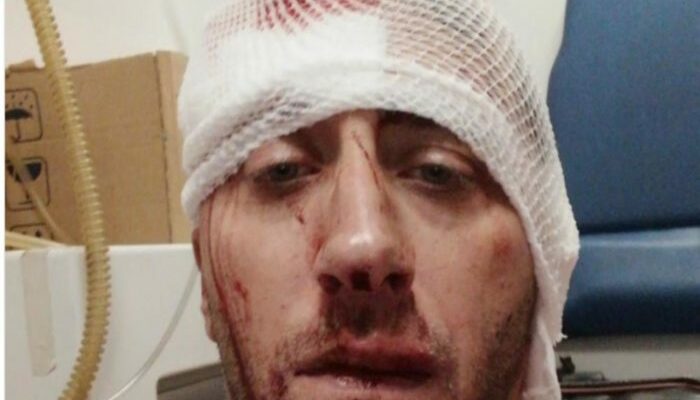 attacks-on-journalists-must-stop!
